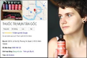 Cách Trị Mụn Dưới Da Tận Gốc