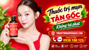 Cách Trị Mụn Tận Gốc